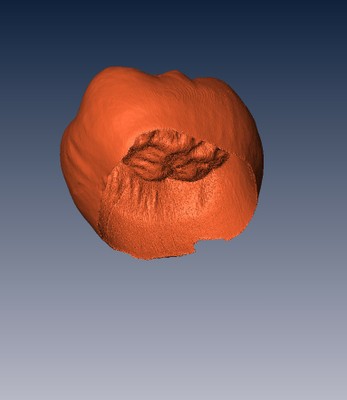 Human Molar Tooth: Enamel Cap Human Molar Tooth: Enamel Cap
