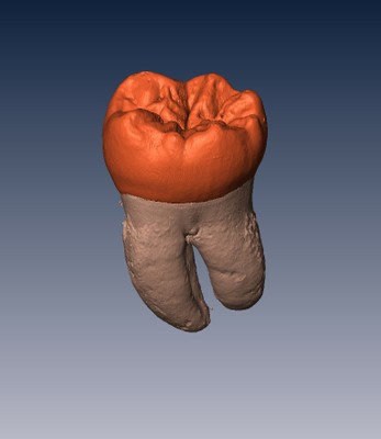 Human Molar Tooth Human Molar Tooth